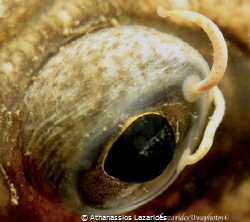 Eye of small flounder infected by parasites by Athanassios Lazarides 